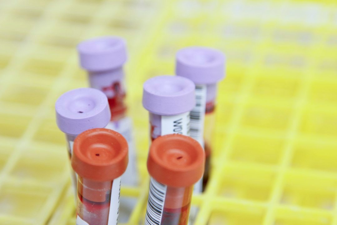 Blood sample tubes representing laboratory monitoring during isotretinoin treatment